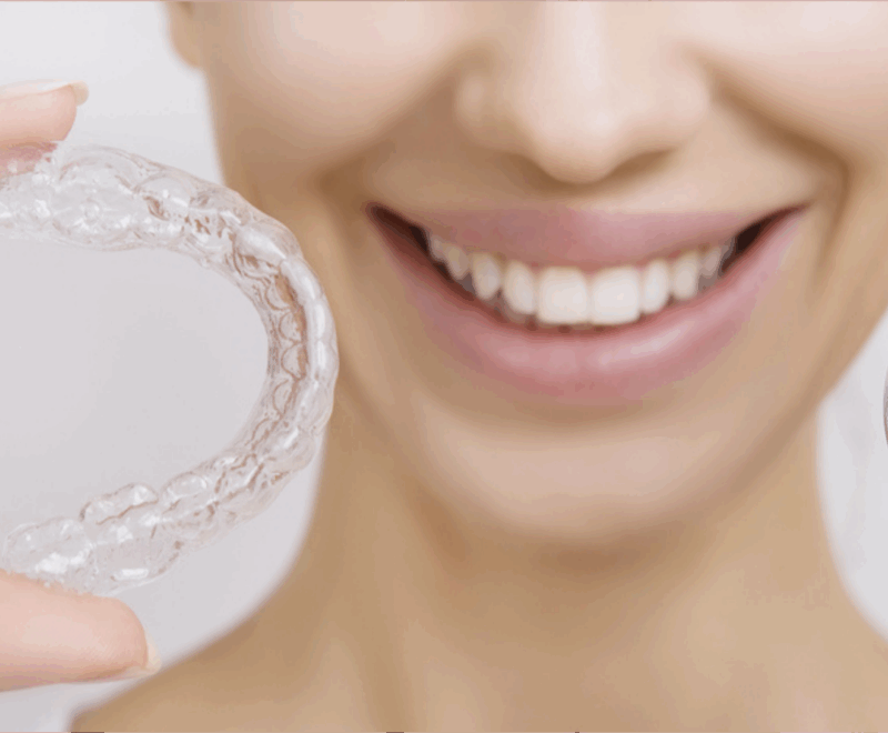invisalign