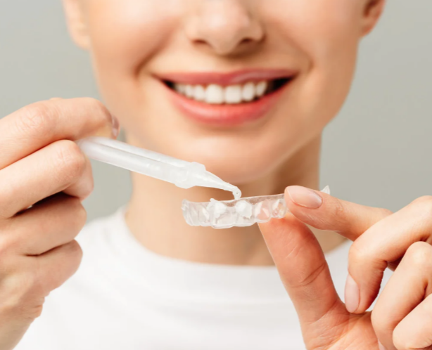 teeth-whitening2